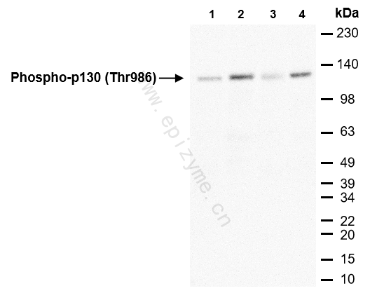 Anti-Phospho-Rb2/p130 (Thr986) Rabbit mAb [69L29M82]