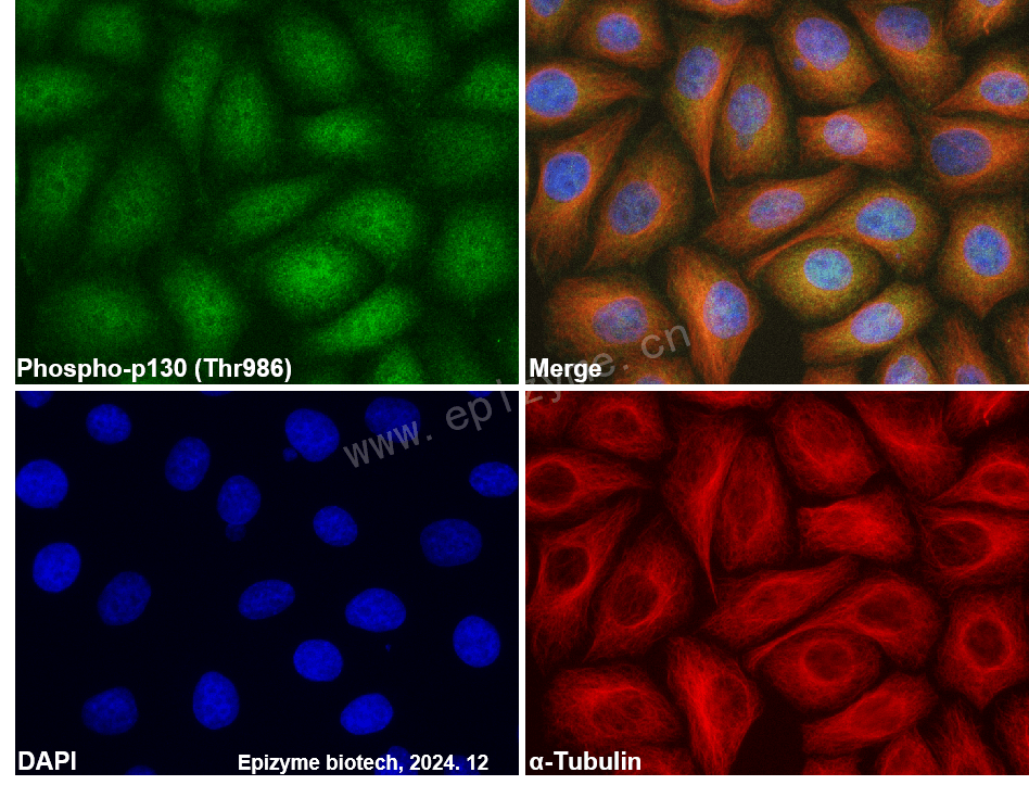 Anti-Phospho-Rb2/p130 (Thr986) Rabbit mAb [69L29M82]