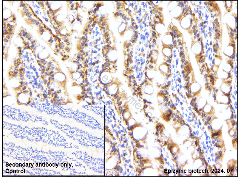 Anti-Insulin Degrading Enzyme Rabbit mAb [54L15M33]