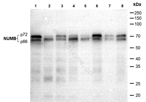 Anti-NUMB Rabbit mAb [64L17L98]
