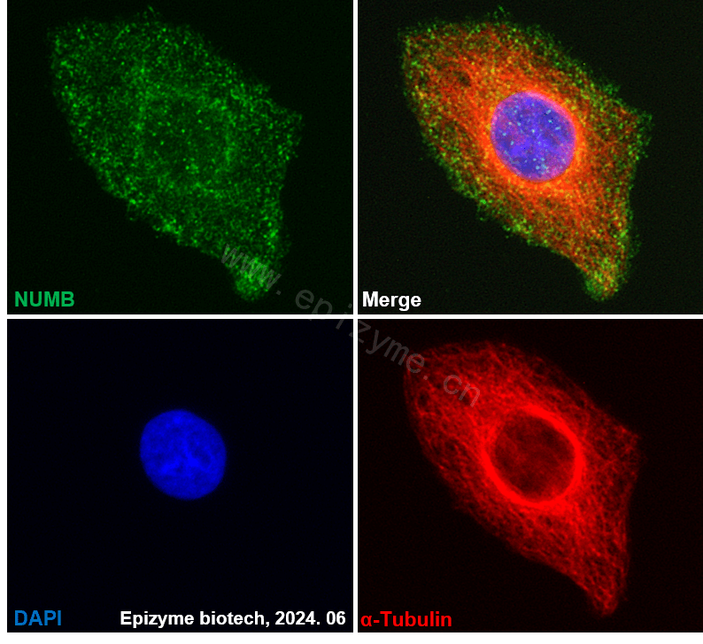 Anti-NUMB Rabbit mAb [64L17L98]