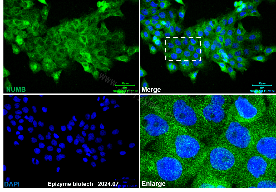 Anti-NUMB Rabbit mAb [64L17L98]