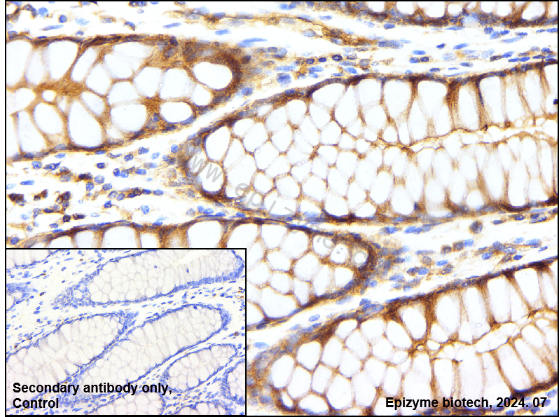 Anti-NUMB Rabbit mAb [64L17L98]