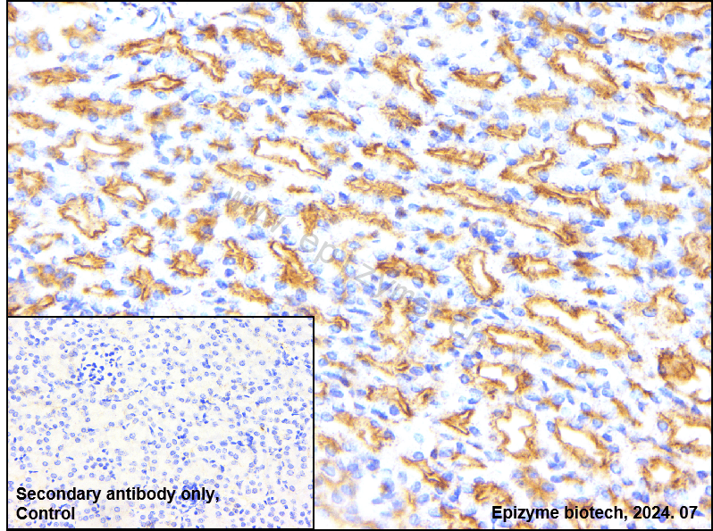 Anti-NUMB Rabbit mAb [64L17L98]