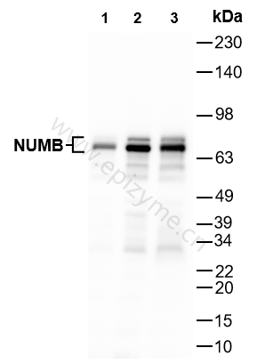 Anti-NUMB Rabbit mAb [64L17L98]