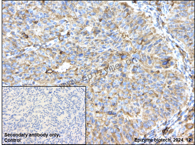 Anti-Rab10 Rabbit mAb [17M75L49]