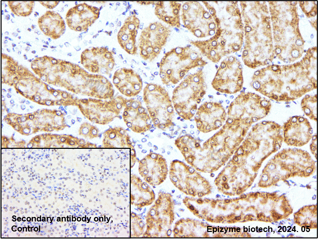 Anti-Phospho-Tau (Ser404) Rabbit mAb [79L99K64]