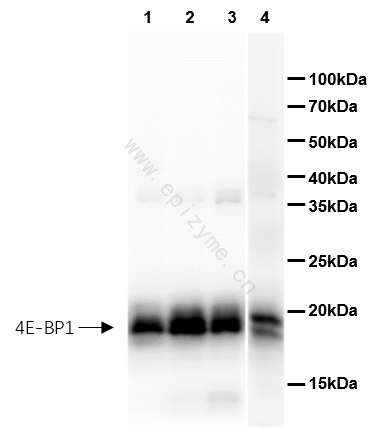 Anti-4E-BP1 Rabbit mAb [17M14K16]