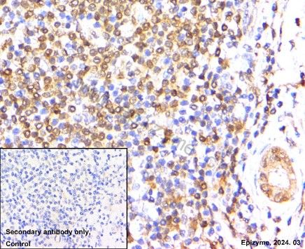 Anti-4E-BP1 Rabbit mAb [17M14K16]