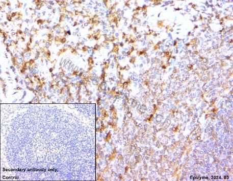 Anti-4E-BP1 Rabbit mAb [17M14K16]