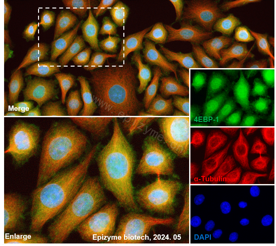 Anti-4E-BP1 Rabbit mAb [17M14K16]