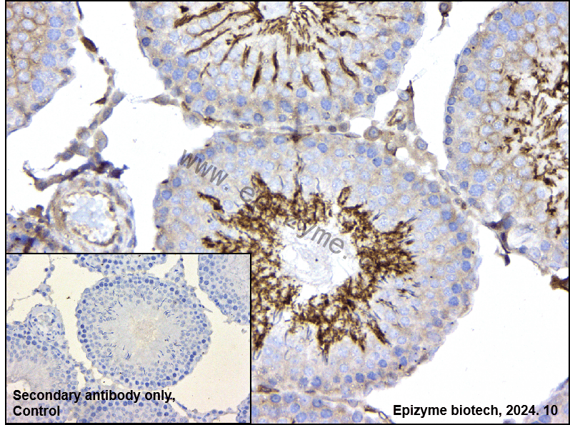 Anti-PI3 Kinase p85 alpha Rabbit mAb [78L02M83]