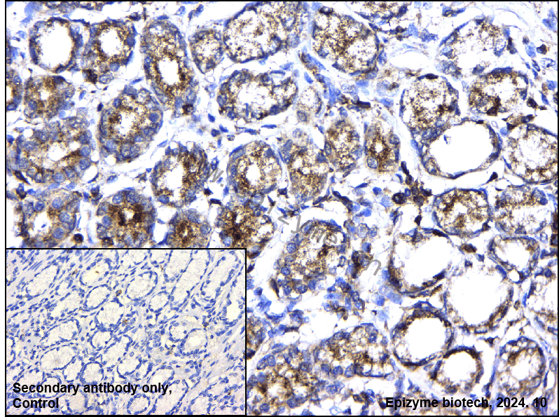 Anti-PI3 Kinase p85 alpha Rabbit mAb [78L02M83]
