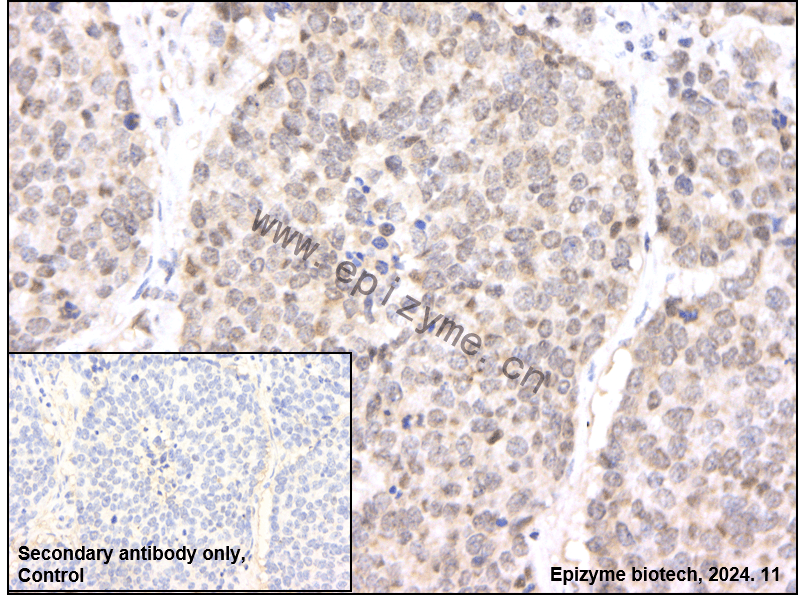 Anti-c-Rel Rabbit mAb [99M07K01]