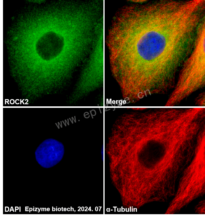Anti-ROCK2 Rabbit mAb [21L73M16]