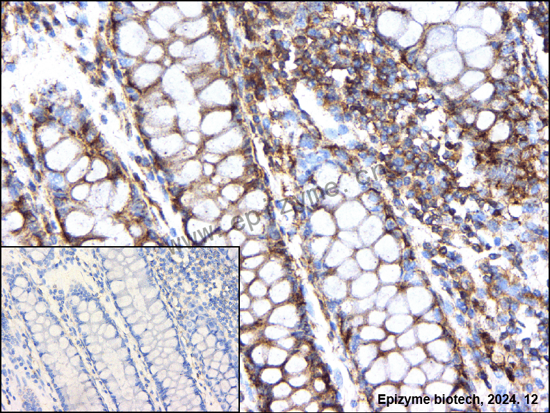 Anti-ROCK2 Rabbit mAb [21L73M16]