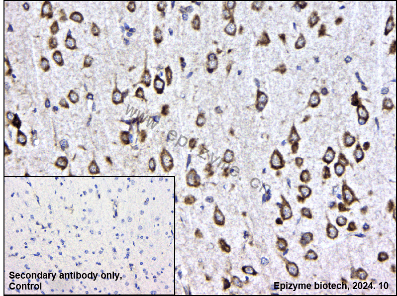 Anti-RACK1 Rabbit mAb [51M96K12]