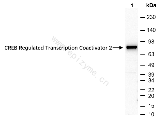Anti-TORC2 Rabbit mAb [11M80M25]