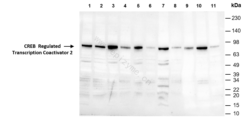 Anti-TORC2 Rabbit mAb [11M80M25]