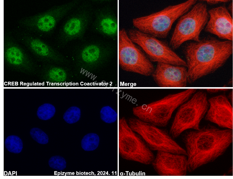 Anti-TORC2 Rabbit mAb [11M80M25]