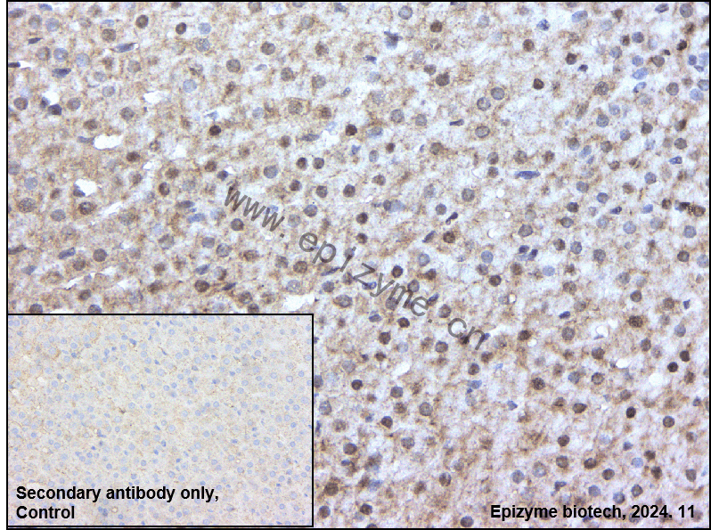 Anti-TORC2 Rabbit mAb [11M80M25]