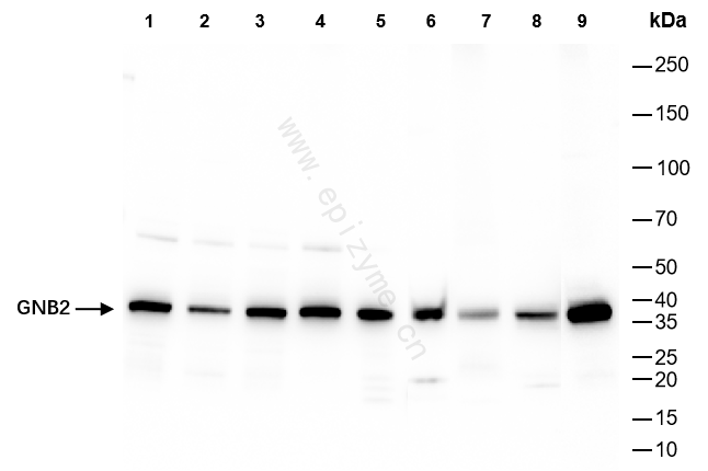 Anti-GNB2 Rabbit mAb [65L64L96]