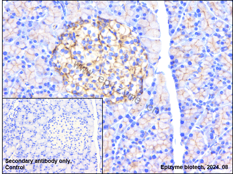 Anti-GNB2 Rabbit mAb [65L64L96]