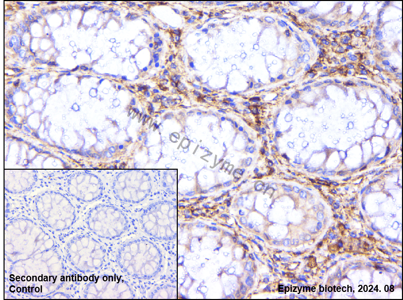 Anti-GNB2 Rabbit mAb [65L64L96]