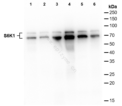Anti-S6K1 Rabbit mAb [62L61L13]
