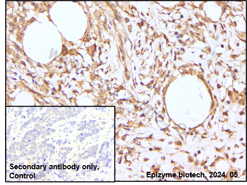 Anti-S6K1 Rabbit mAb [62L61L13]