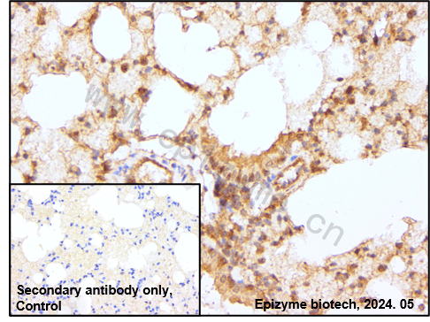 Anti-S6K1 Rabbit mAb [62L61L13]