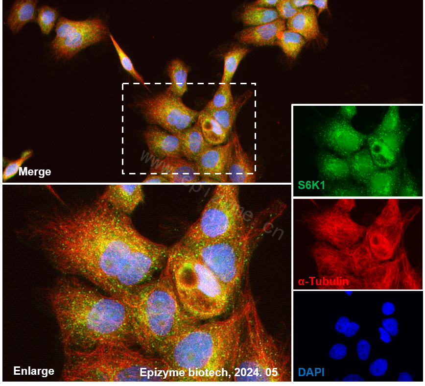 Anti-S6K1 Rabbit mAb [62L61L13]
