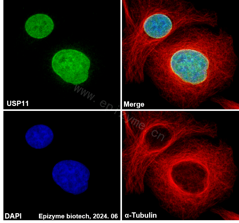 Anti-USP11 Rabbit mAb [26L61K41]
