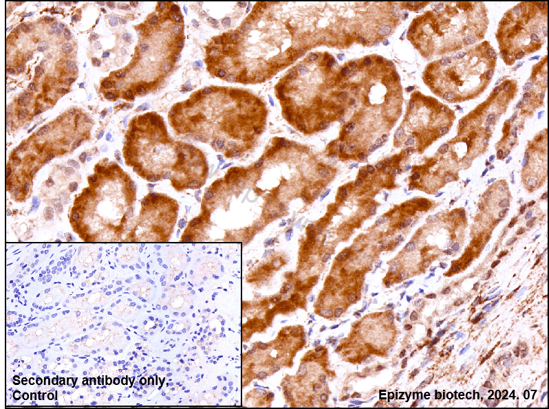 Anti-USP11 Rabbit mAb [26L61K41]