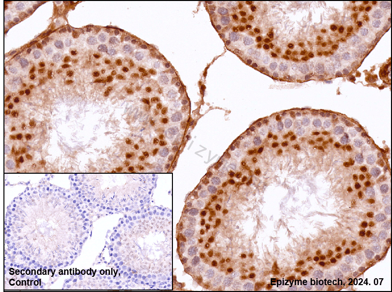 Anti-USP11 Rabbit mAb [26L61K41]