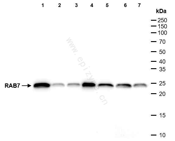 Anti-RAB7 Rabbit mAb [32K32K61]