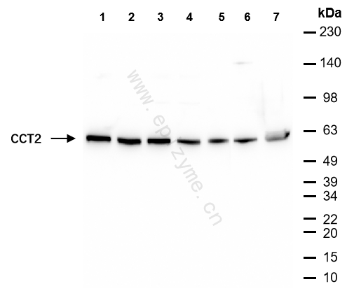 Anti-CCT2 Rabbit mAb [51L53M37]