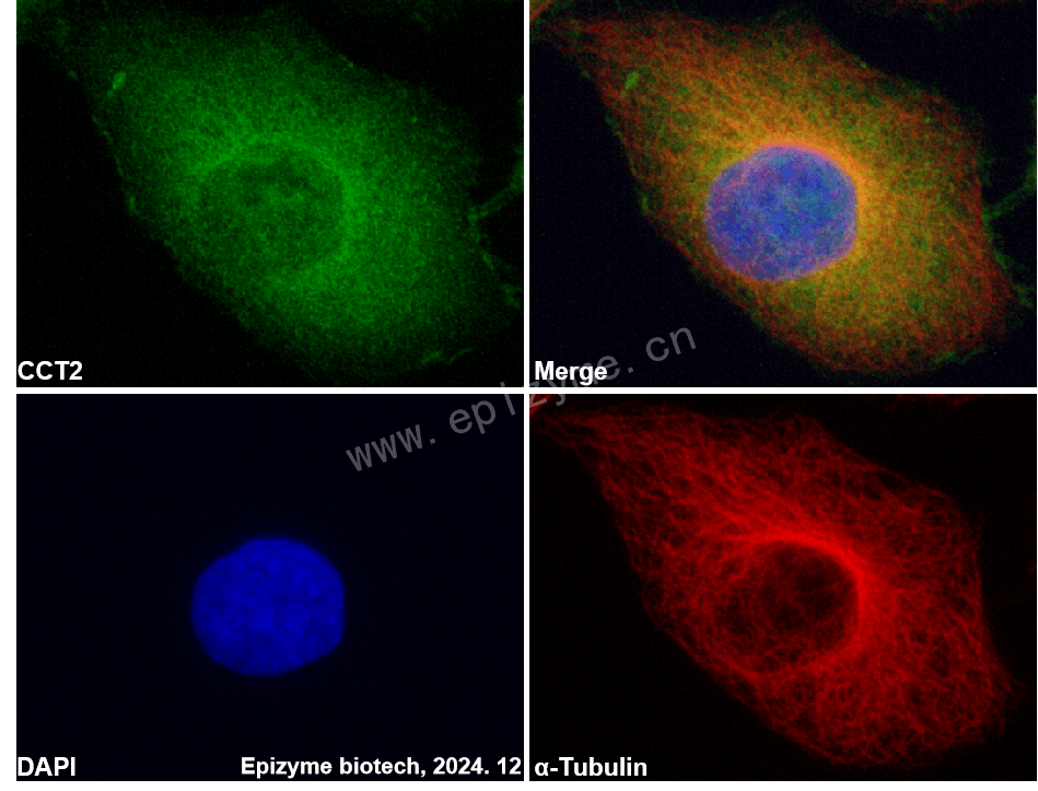 Anti-CCT2 Rabbit mAb [51L53M37]