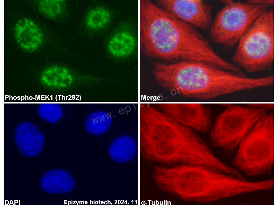 Anti-Phospho-MEK1 (Thr292) Rabbit mAb [16L47M26]