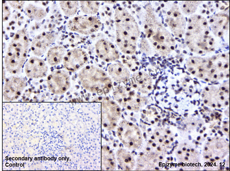 Anti-Phospho-MEK1 (Thr292) Rabbit mAb [16L47M26]
