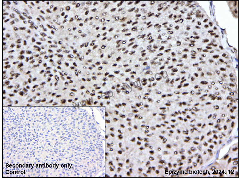 Anti-Phospho-MEK1 (Thr292) Rabbit mAb [16L47M26]