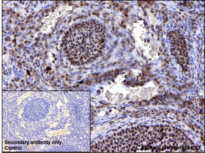 Anti-Phospho-MEK1 (Thr292) Rabbit mAb [16L47M26]