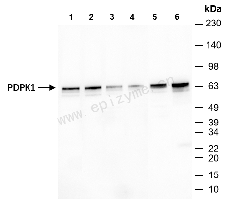 Anti-PDPK1 Rabbit mAb [36K73K16]