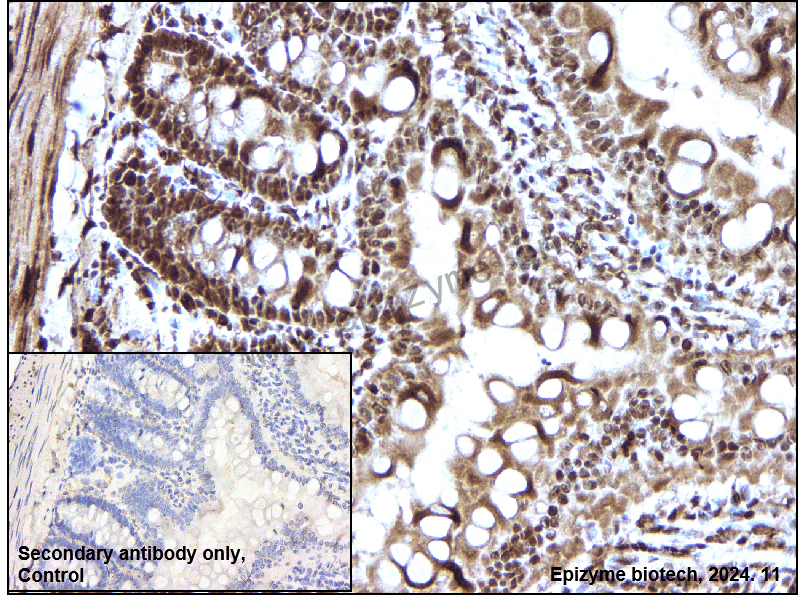 Anti-ENT2 Rabbit mAb [29K61K10]