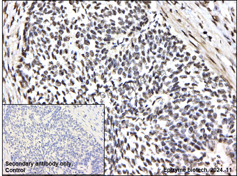 Anti-ENT2 Rabbit mAb [29K61K10]