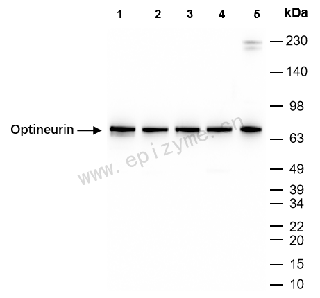 Anti-Optineurin Rabbit mAb [64M22K82]