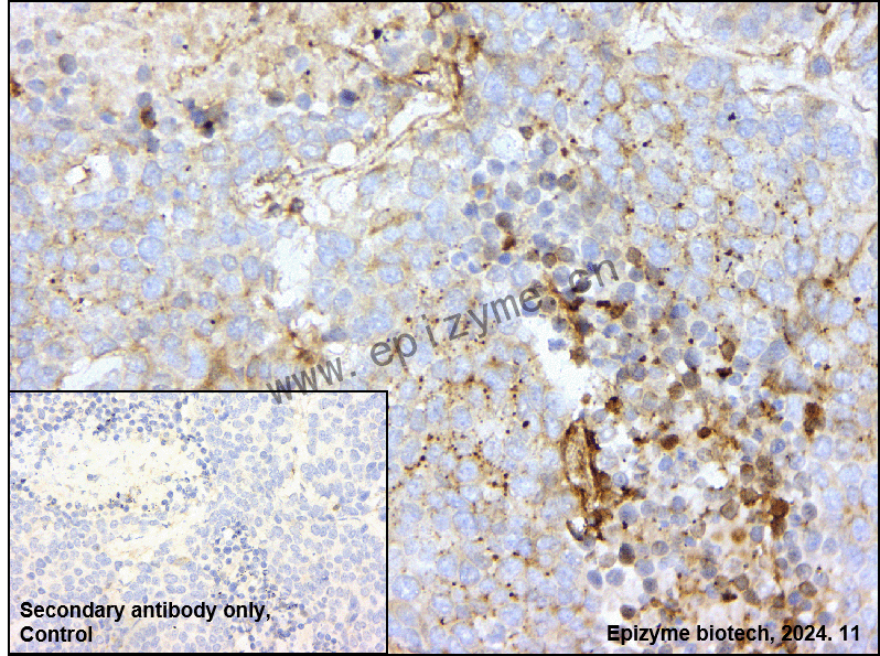 Anti-Optineurin Rabbit mAb [64M22K82]