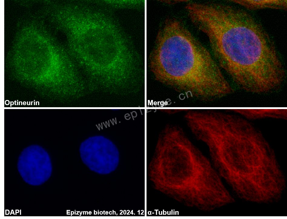 Anti-Optineurin Rabbit mAb [64M22K82]