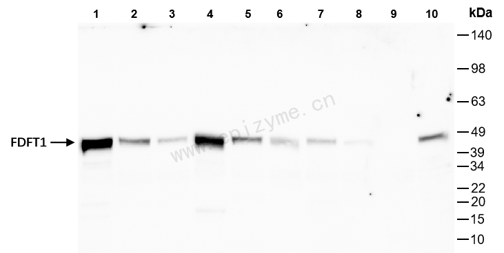 Anti-FDFT1 Rabbit mAb [20L04L51]