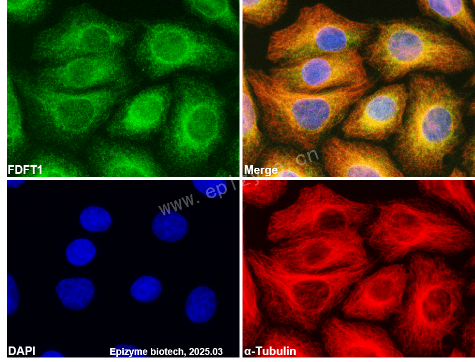 Anti-FDFT1 Rabbit mAb [20L04L51]